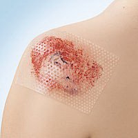 Wound Contact Layer Dressing Cuticell® Contact® 3 X 4 Inch Sterile - BeHope
