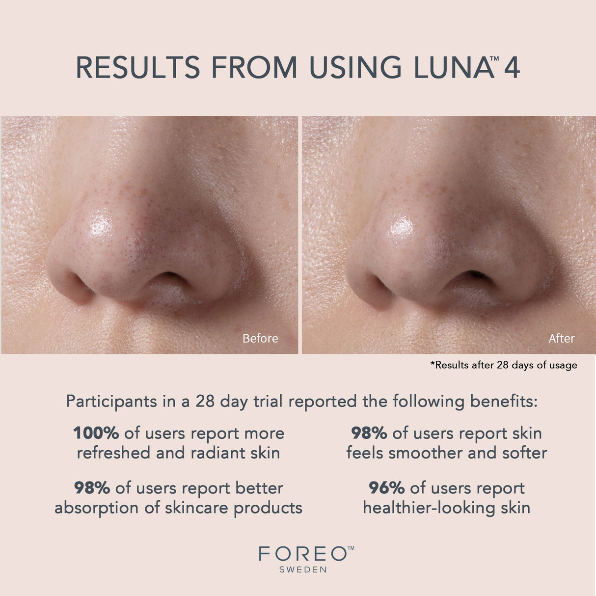 Facial Cleansing Brush and Massage Device LUNA™ 4 Balanced Skin - BeHope