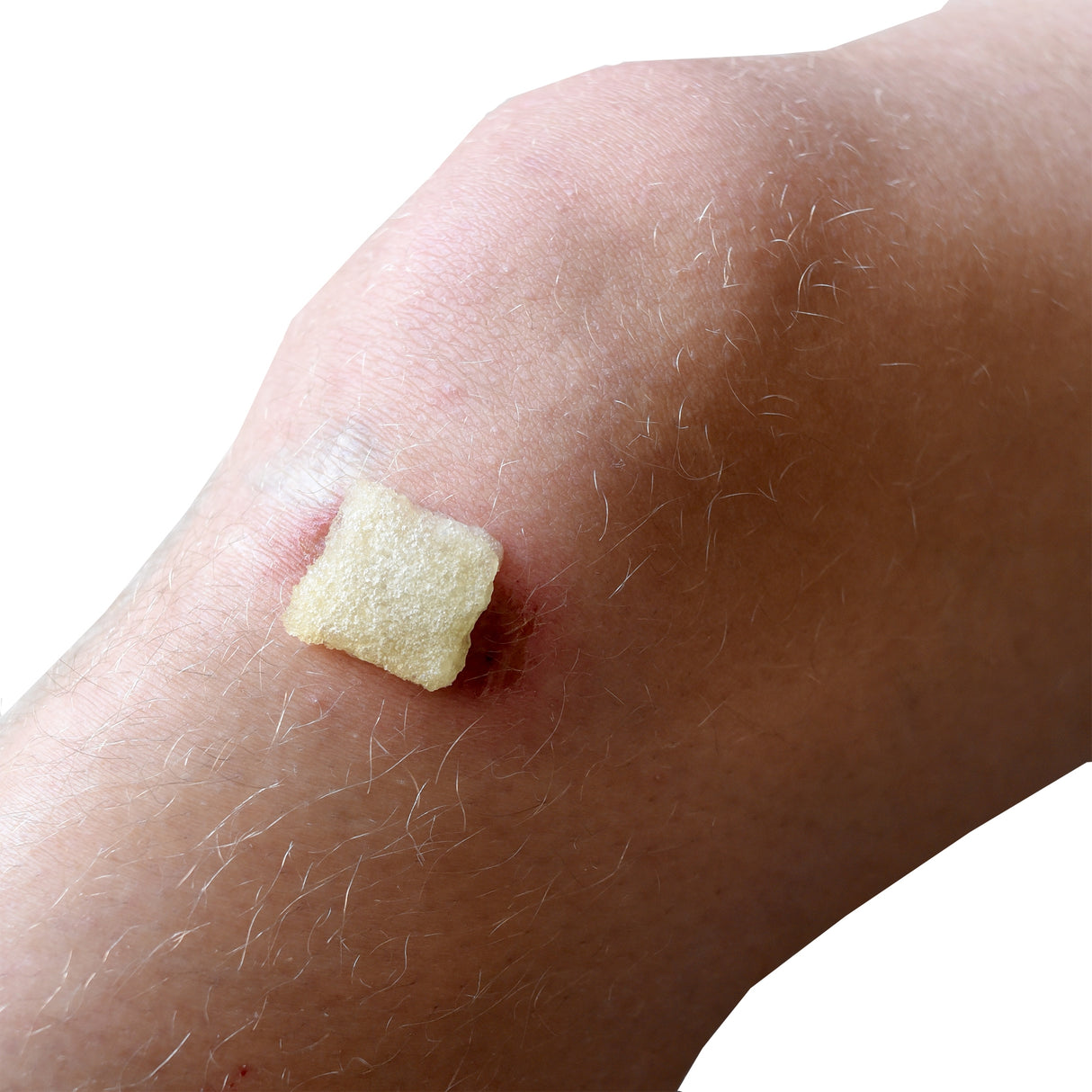 Honey Wound Dressing Veris™ Sterile Dissolving Non-Sticky Sheet - BeHope