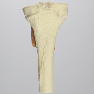 Replacement Proximal Tibia Bone With Skin Patch Sawbone Adult Size / Foam Cortical Shell - Behope