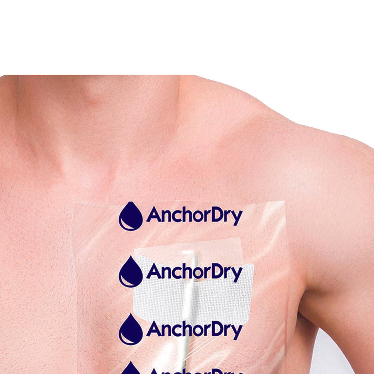 IV Site Barrier Protector AnchorDry™ 7 X 7 Inch NonSterile - BeHope