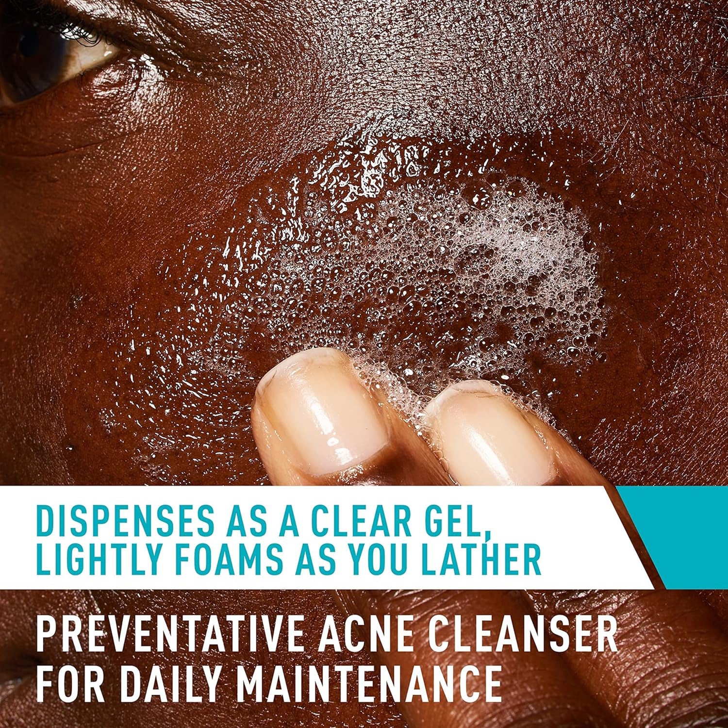 Acne Treatment CeraVe® Acne Control Cleanser 8 oz. Gel - BeHope