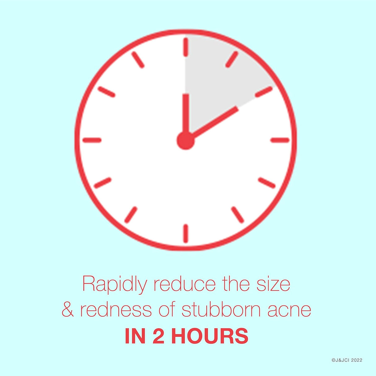 Acne Treatment Neutrogena® Rapid Clear 1 oz. Gel - BeHope