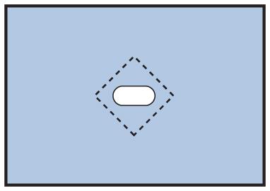 Medline Nonsterile Minor Procedure Drapes - BeHope