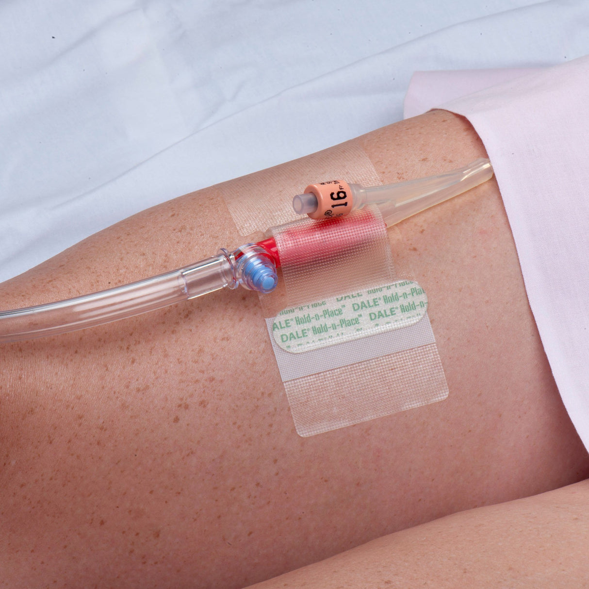 Catheter Holder Hold-n-Place® One Size Fits All, Adhesive Patch - BeHope