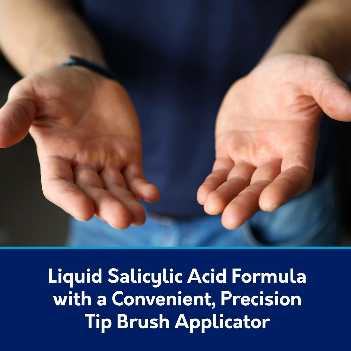 Wart Remover Compound W® 17% Strength Topical Solution 0.31 oz. - BeHope