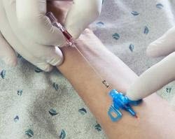 Closed IV Catheter Introcan Safety® 3 20 Gauge 1 Inch Polyurethane Winged Hub Blood Control Passive Safety - BeHope