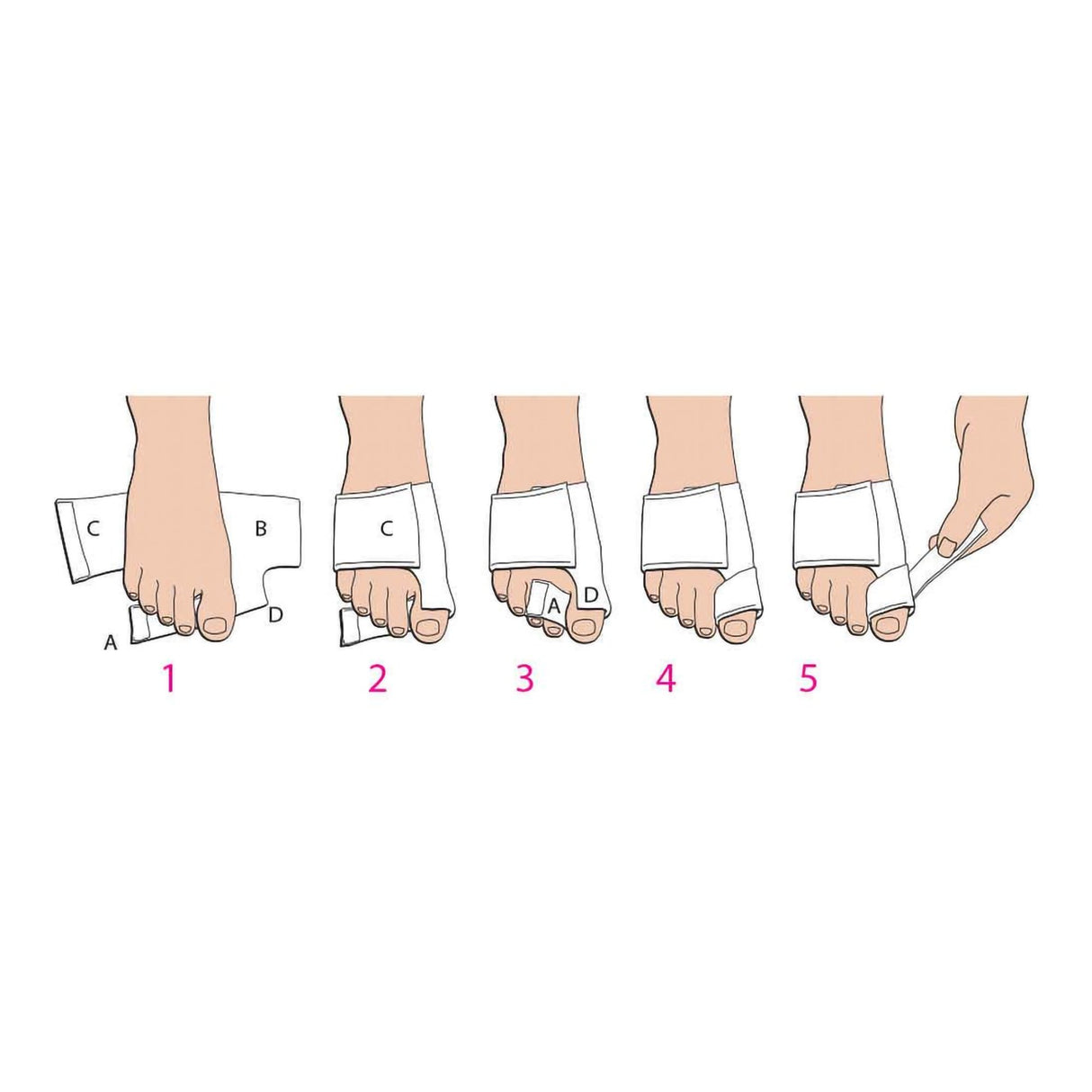 Bunion Splint Softsplint™ Medium Left Foot - BeHope