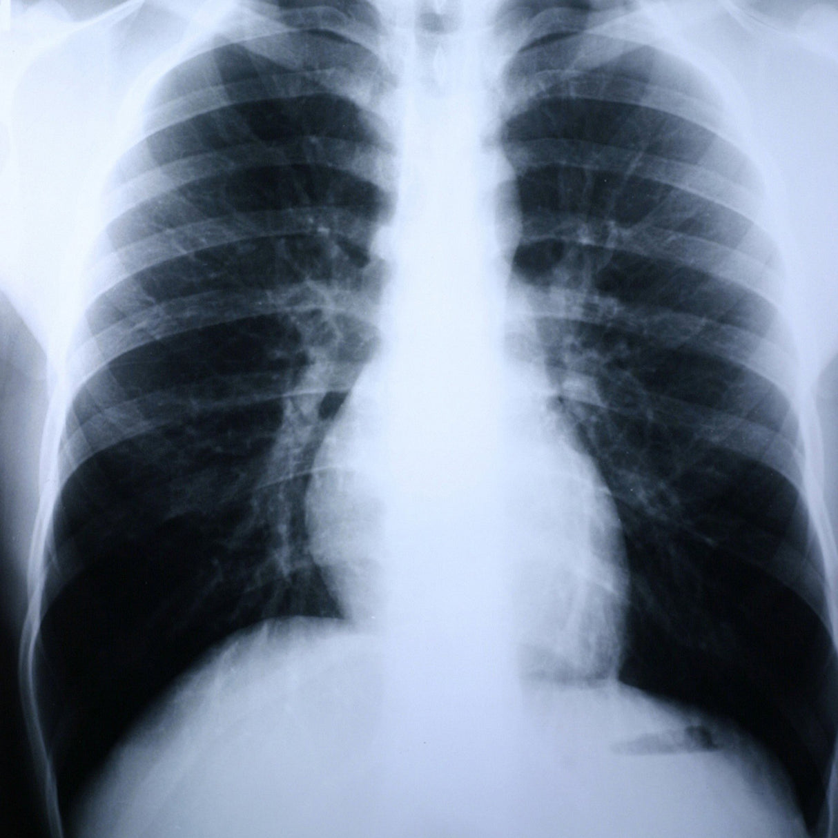 X-Ray Film Clear Choice™ Performance 8 X 10 Inch Medium Speed Green Sensitive High - BeHope