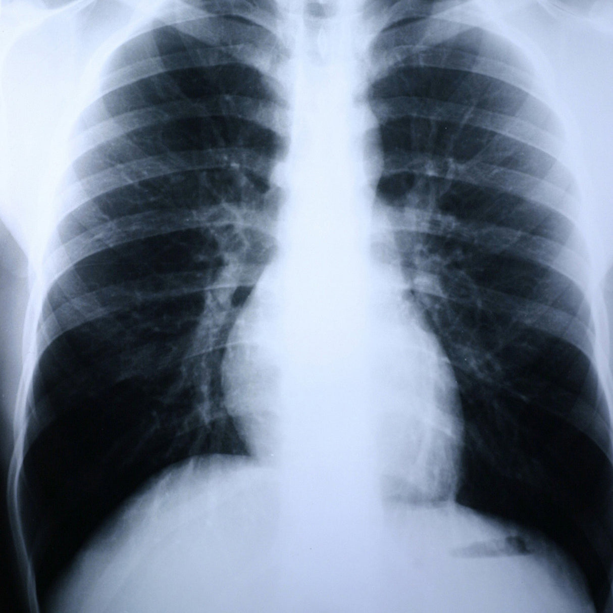 X-Ray Film Clear Choice™ Performance 14 X 17 Inch Medium Speed Green Sensitive High - BeHope