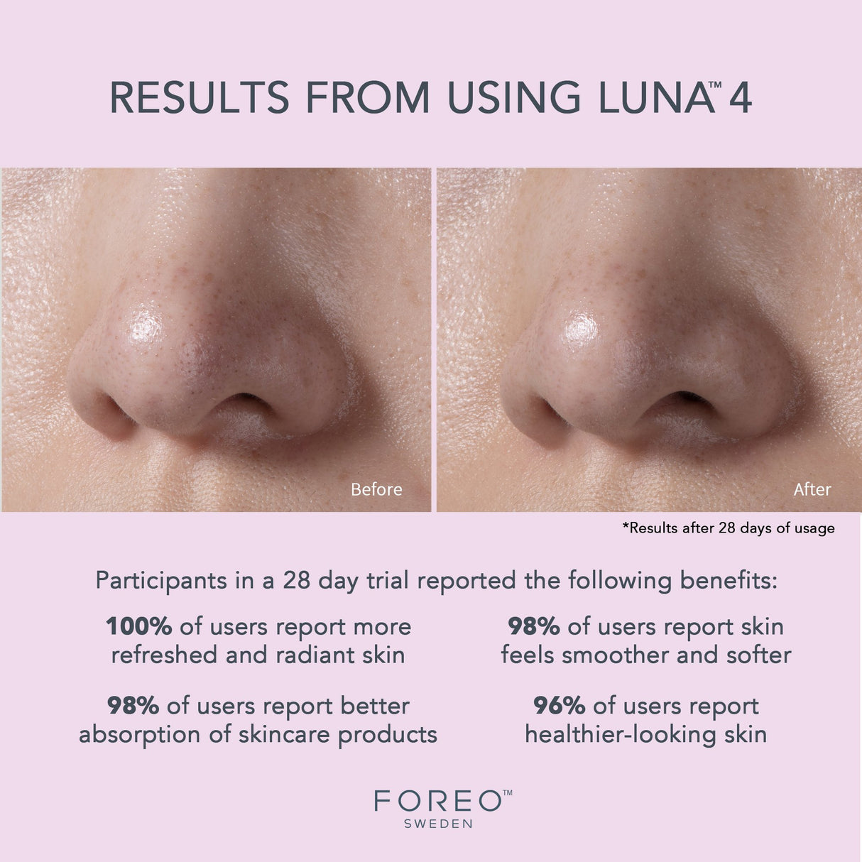 Facial Cleansing Brush and Massage Device LUNA 4 Sensitive Skin - BeHope