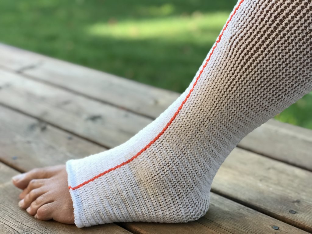 Edemawear Lite Lymphedema Stockinet