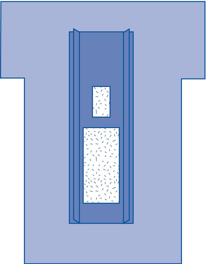 Cardiovascular Incise Surgical Drape - BeHope