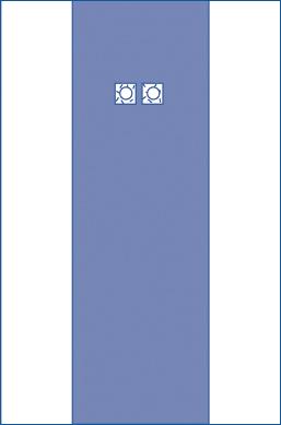 Medline Nonsterile Fem/Angio Drapes