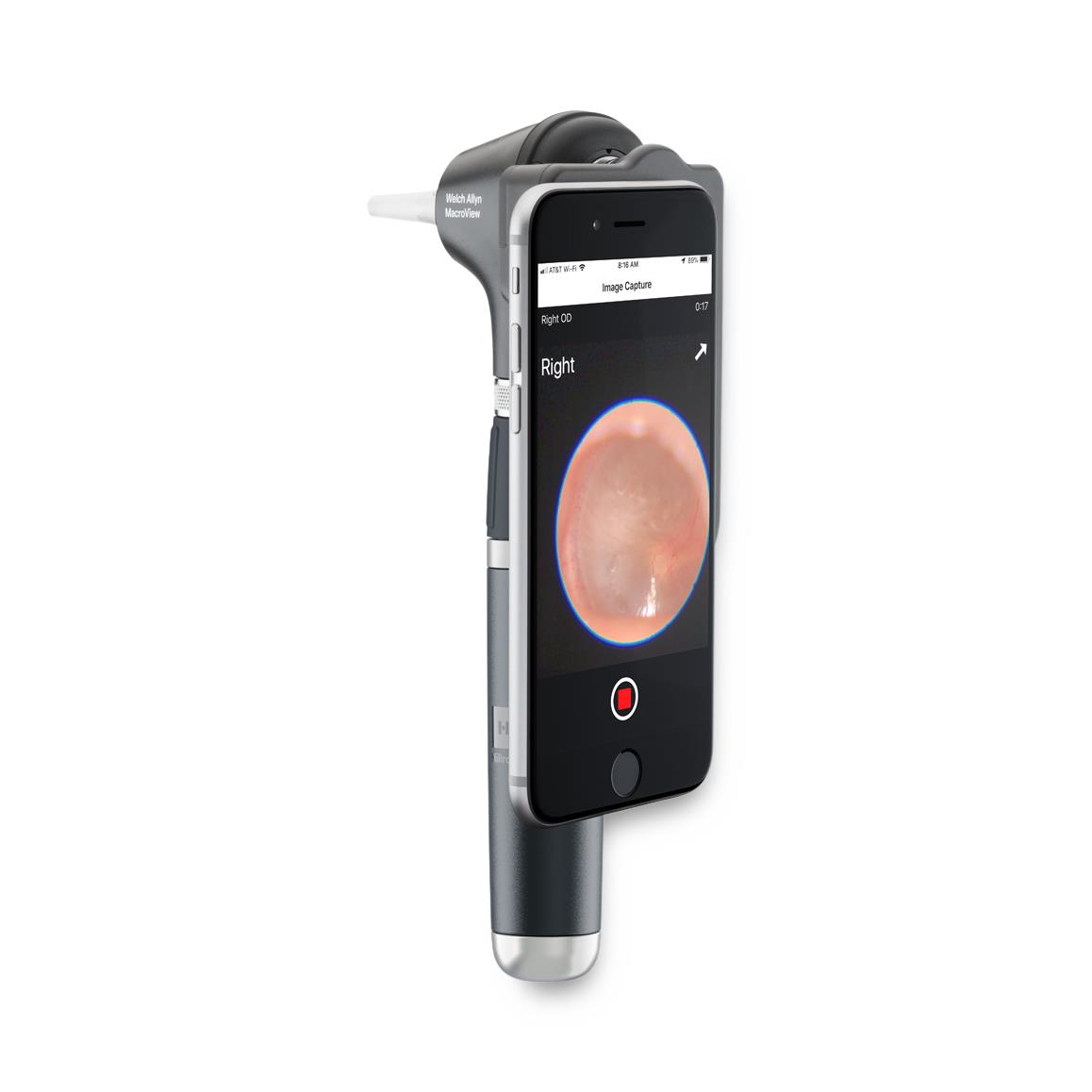Macroview Otoscopes And Accessories - BeHope