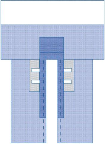 Sterile Cardiovascular Split Drapes with Clear Anesthesia Screen and Pouch