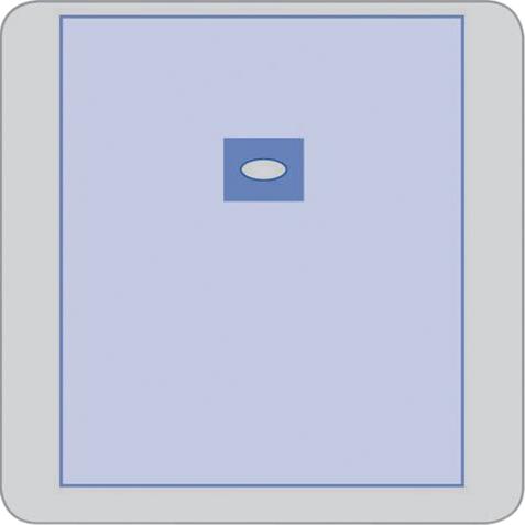 Invisishield Aperture Surgical Drapes