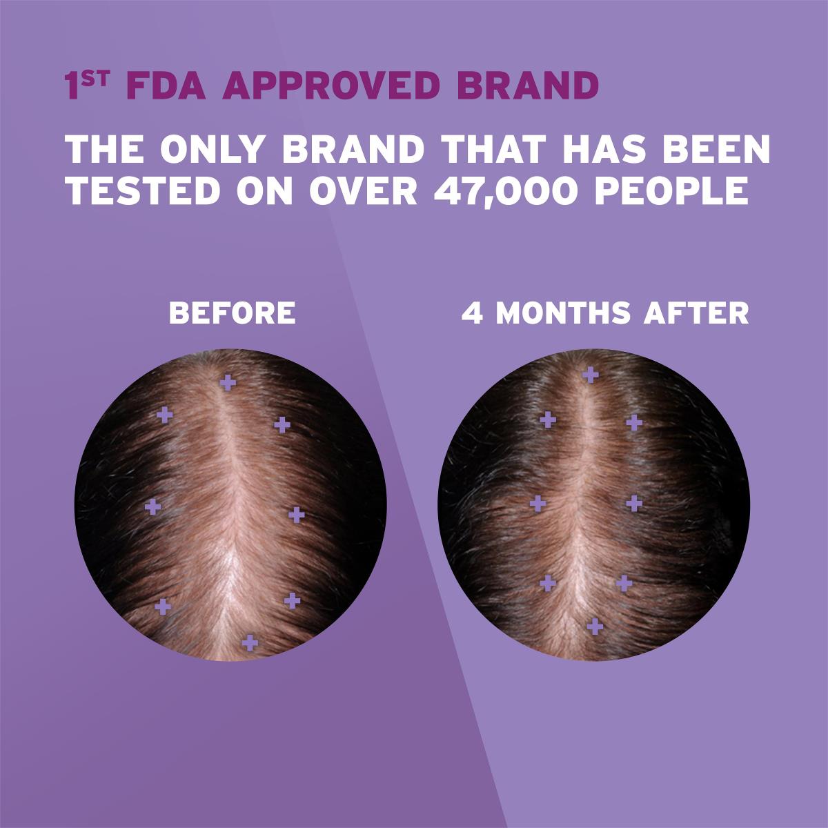 Women's Rogaine 2% Minoxidil Solution - BeHope