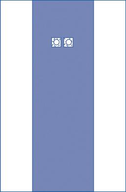 Sterile Femoral Angiography Surgical Drapes - BeHope