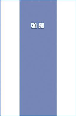 Sterile Femoral Angiography Surgical Drapes - BeHope