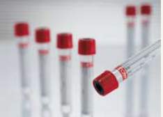 Vacuette® Venous Blood Collection Tube Serum Clot Activator Pull Cap - BeHope