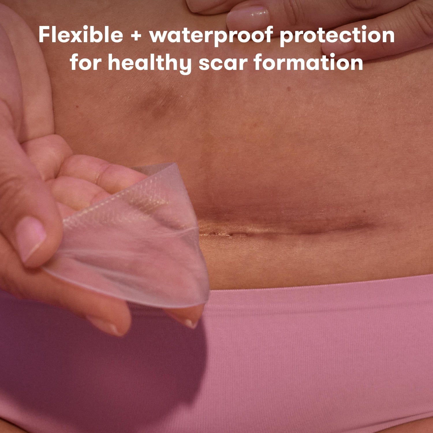 Silicone Skin Strip frida mom C-Section 8 Inch Rectangle NonSterile - BeHope