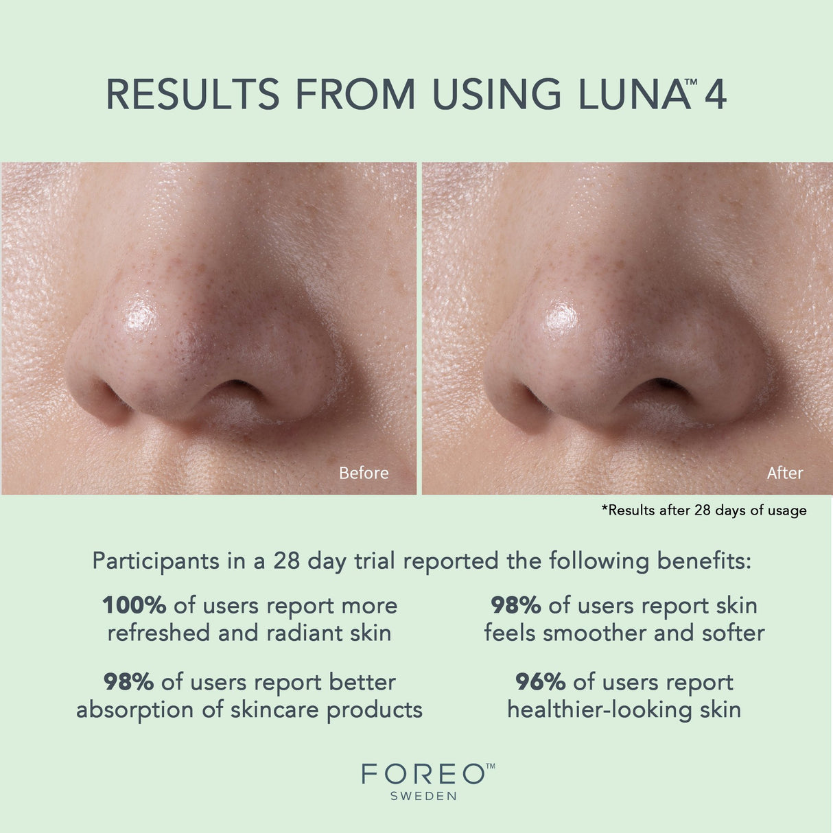 Facial Cleansing Brush and Massage Device LUNA 4 Combination Skin - BeHope