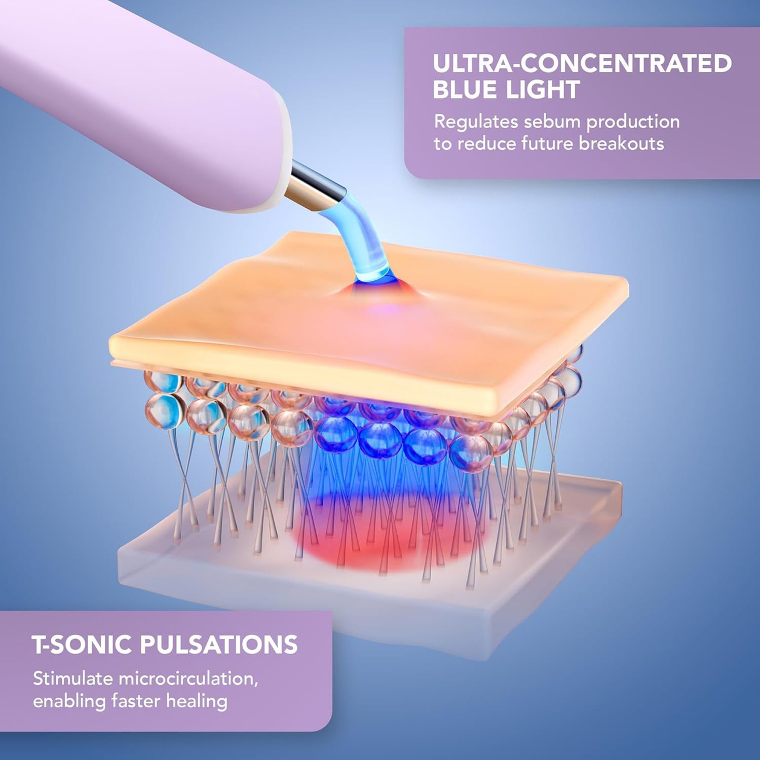 Acne Treatment ESPADA™ 2 plus - BeHope