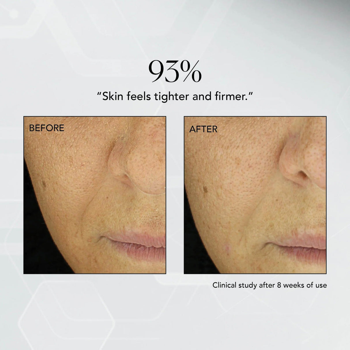 Facial Moisturizer MD Advanced Hydration Crème 1.7 oz. Bottle Unscented Cream - BeHope