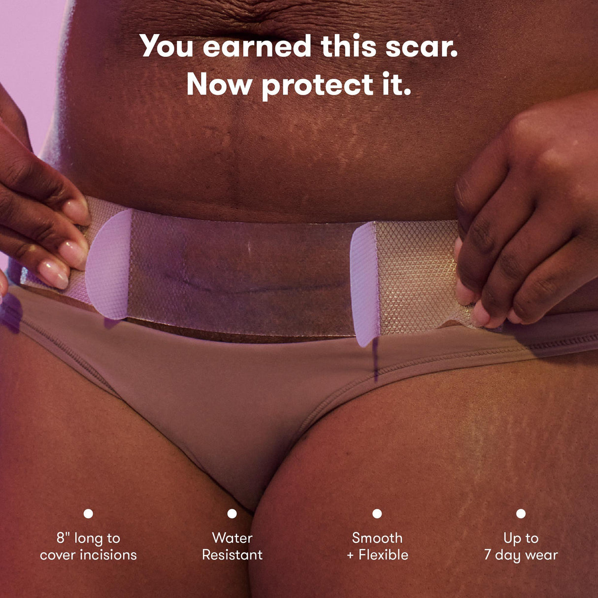 Silicone Skin Strip frida mom C-Section 8 Inch Rectangle NonSterile - BeHope