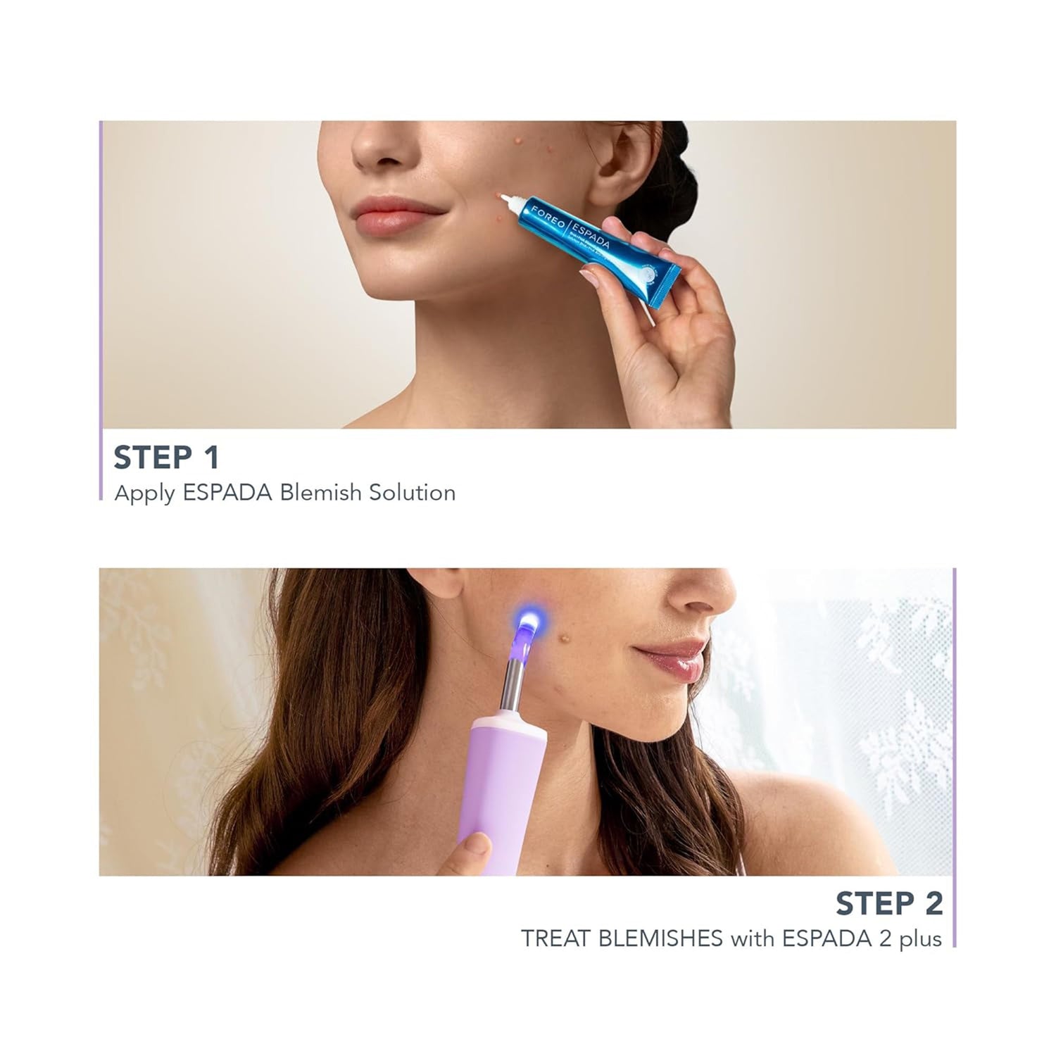 Acne Treatment ESPADA™ 2 plus - BeHope