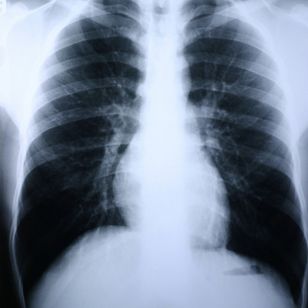 X-Ray Film Clear Choice™ Performance 10 X 12 Inch Medium Speed Green Sensitive High - BeHope