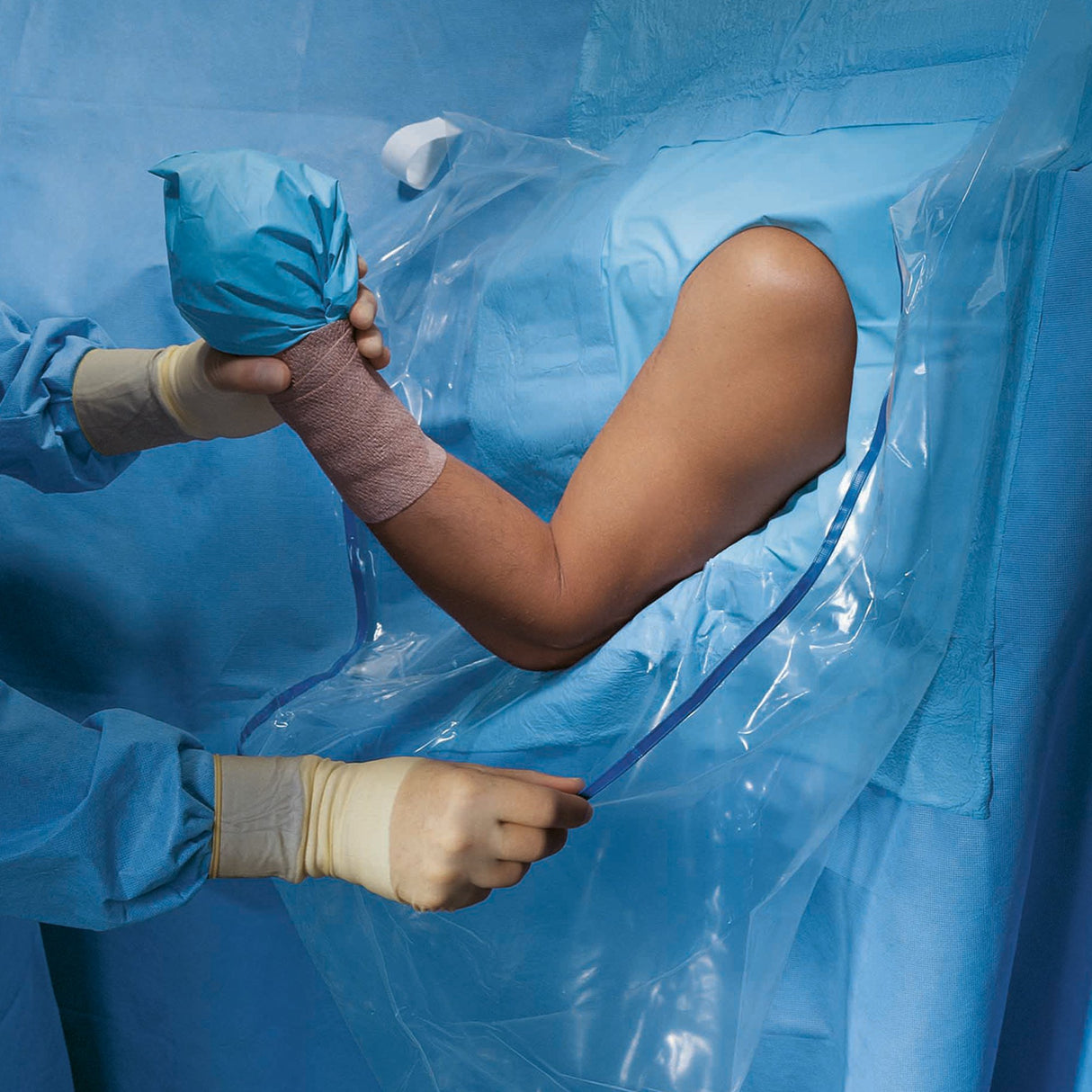 Orthopedic Drape Shoulder Arthroscopy Drape 160 W X 102 L Inch Sterile - BeHope