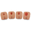 Pressure Ulcer / Bedsore Model Life/form® - BeHope
