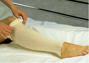 Stockinette Tubular Albahealth® 3 Inch X 25 Yard Cotton NonSterile - BeHope