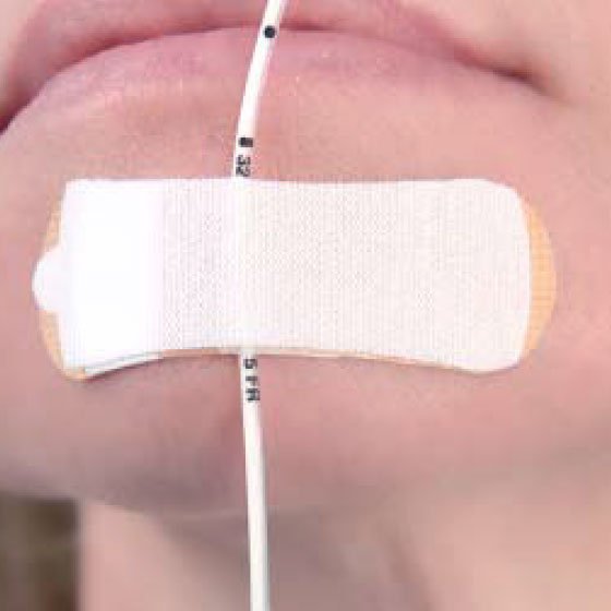 Piercing Probe For Hematology Analyzer - BeHope