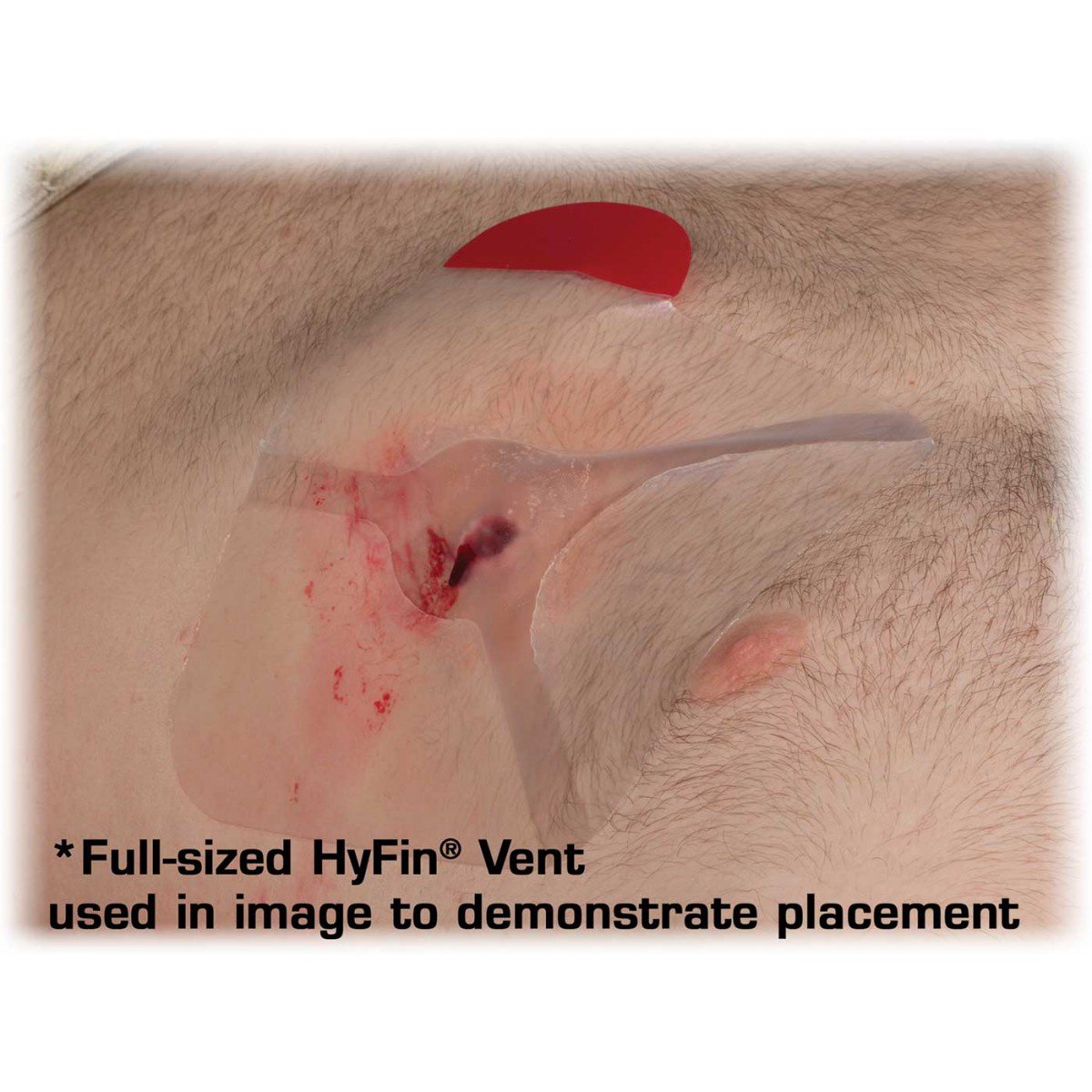 Chest Wound Seal HyfinÂ® Vent Compact 4-3/4 X 4-3/4 Inch 2 per Pack NonSterile - BeHope