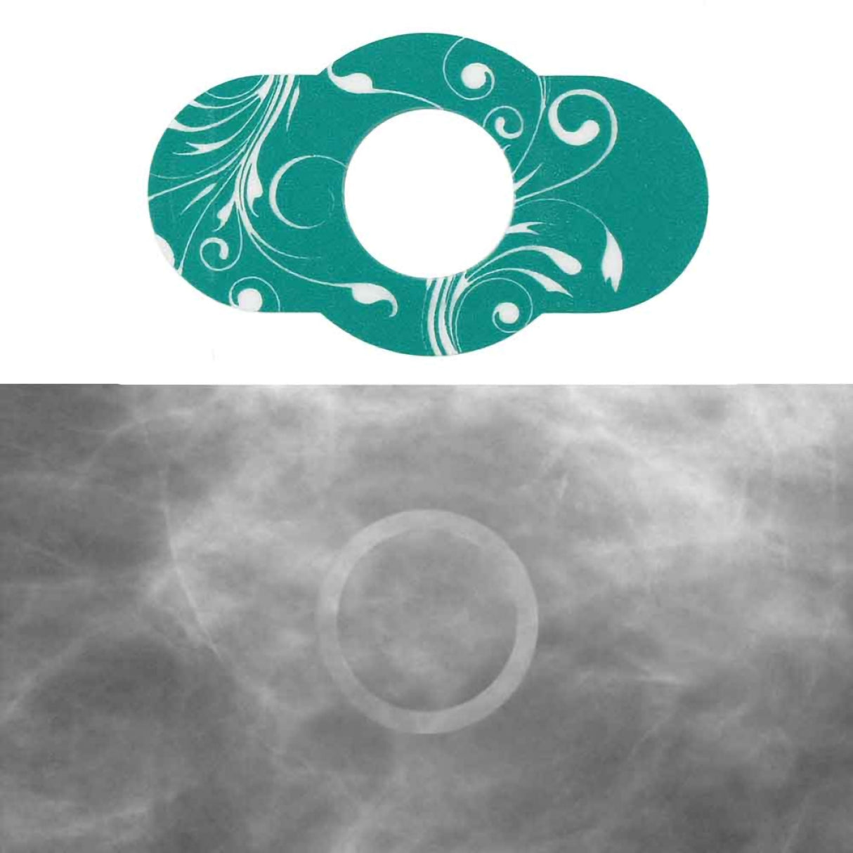 Radiology Skin Marker Spee-d-line™ 3D Tomosynthesis Mole Marker - BeHope