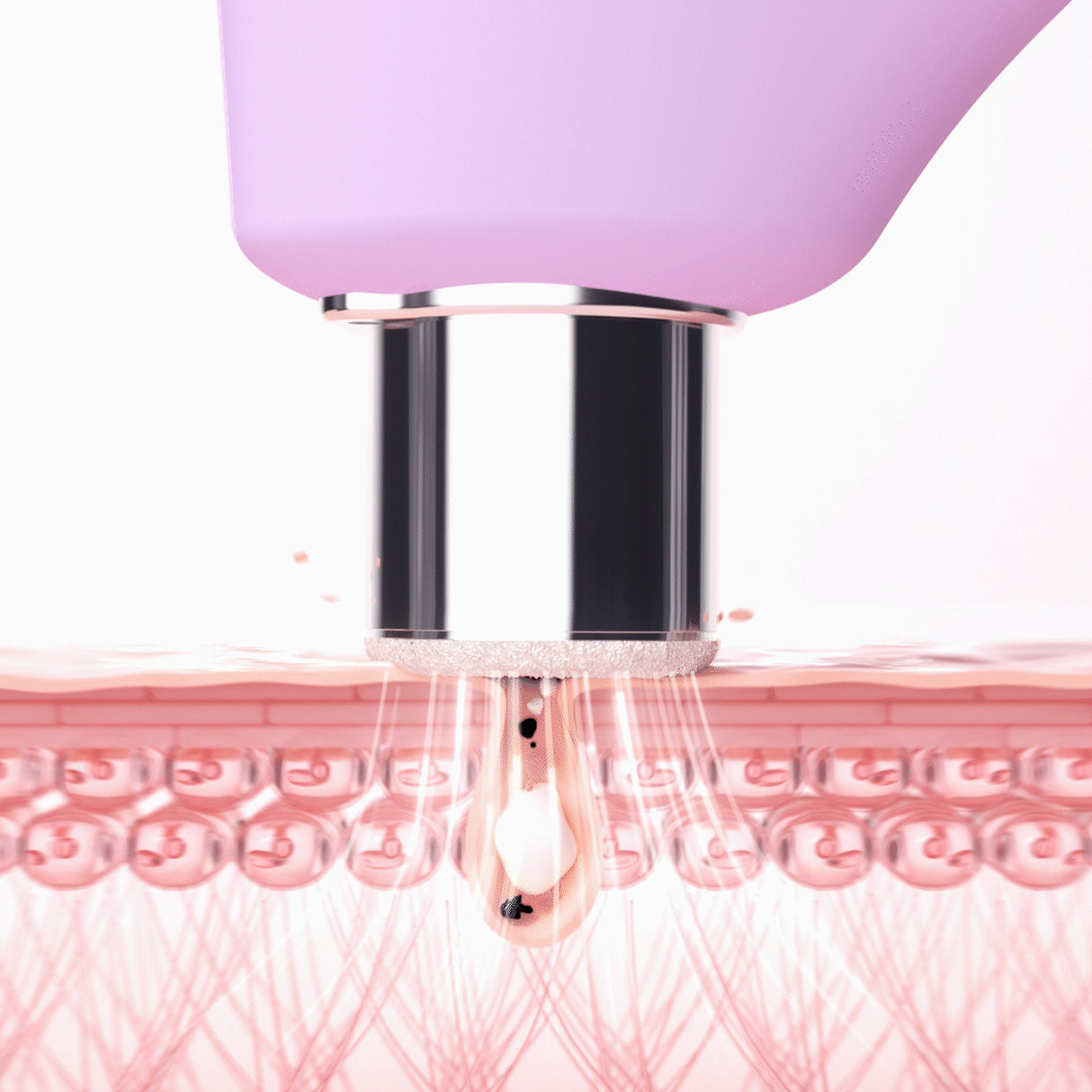 Diamond Microdermabrasion Pore Vacuum KIWI derma