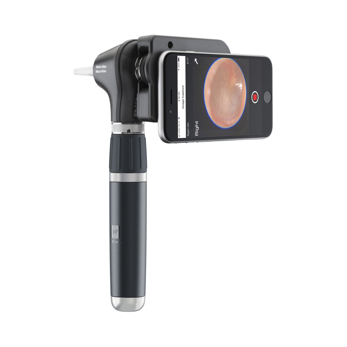 Otoscope Head Welch Allyn® MacroView® Plus Standard Type Adult - BeHope