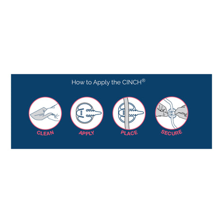 Tube Securement Device CINCH® Large - BeHope