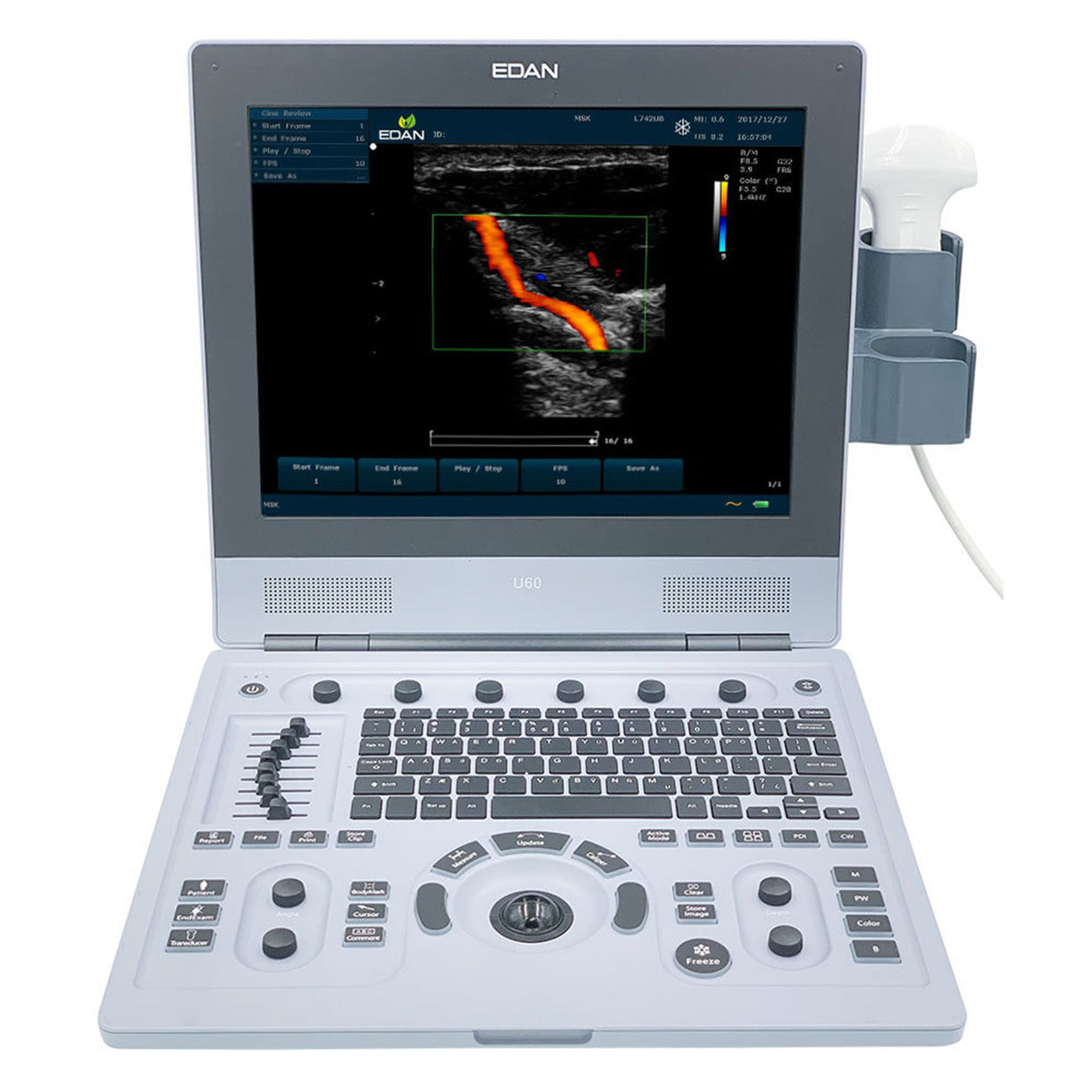 Ultrasound System EDAN U60 - BeHope