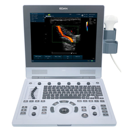 Ultrasound System EDAN U60 - BeHope