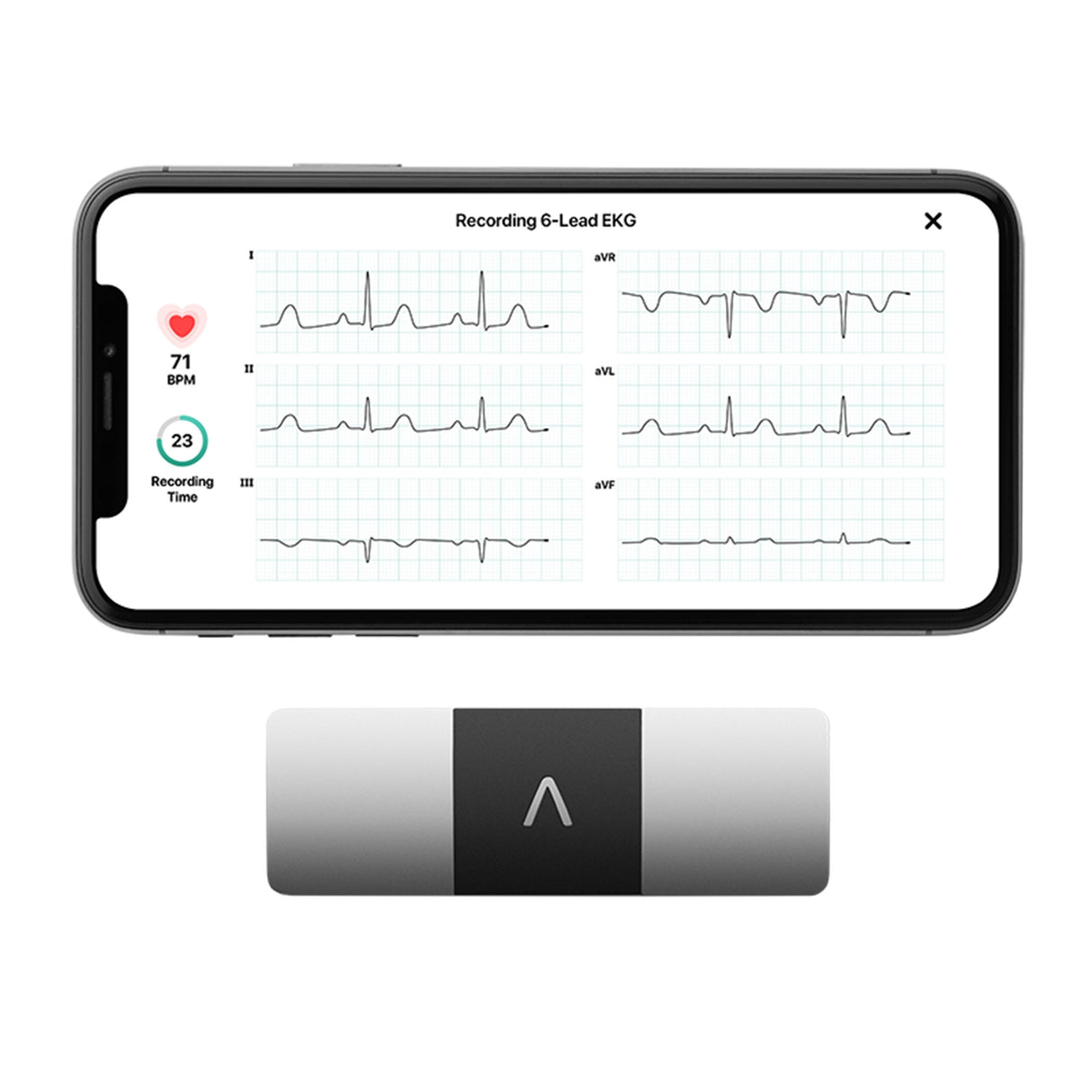 KardiaMobile® 6L FDA Cleared 6 Lead Personal EKG - BeHope
