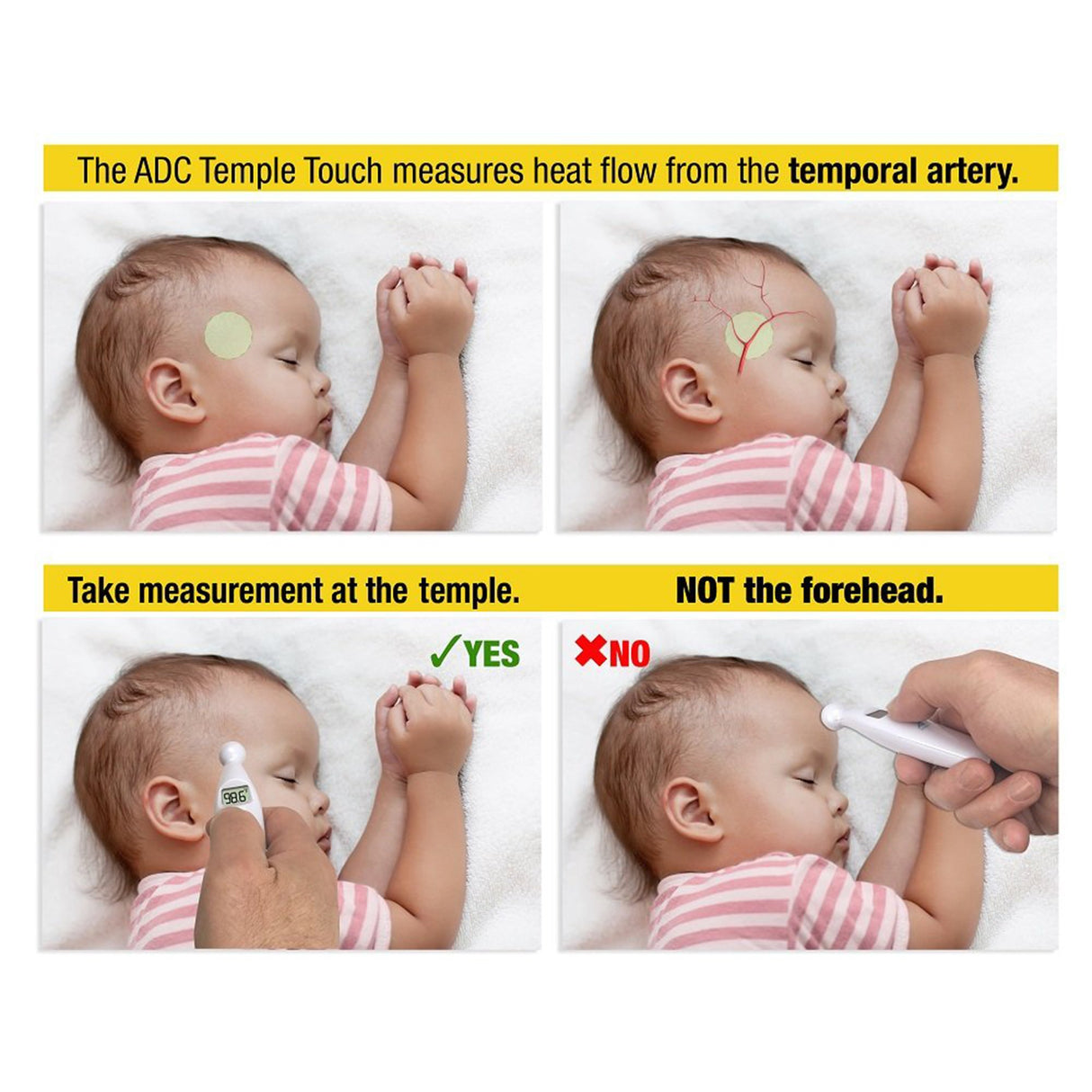 Temporal Contact Thermometer Adtemp™ 427 Temporal Probe Handheld - BeHope