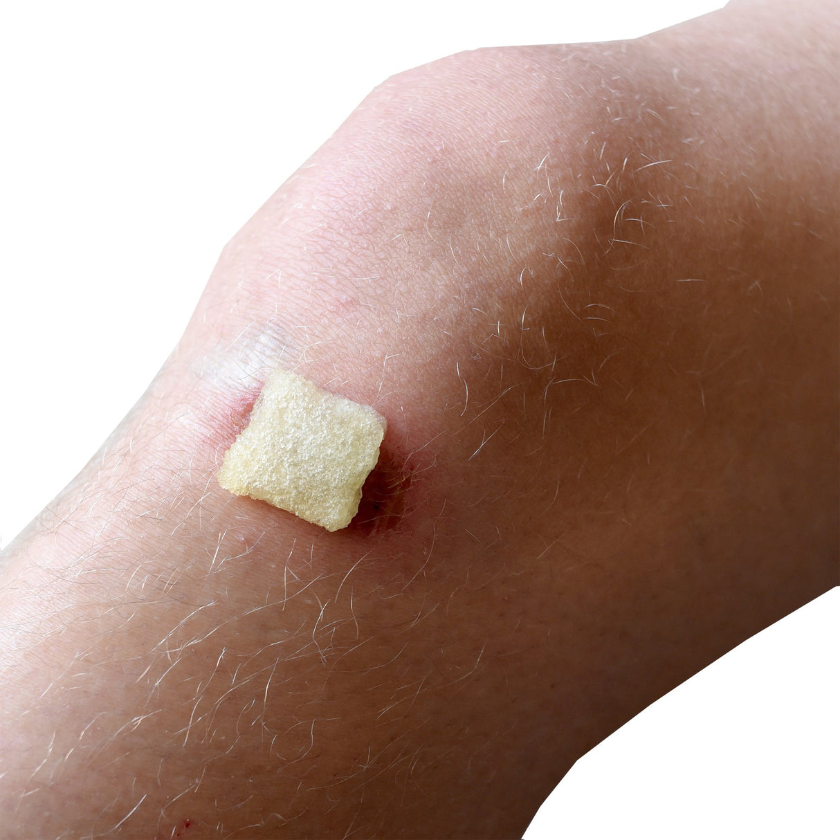 Honey Wound Gel VERISâ„¢ Square 1 X 1 Inch Sheet Sterile Without Adhesive - BeHope