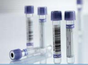 VACUETTE® Venous Blood Collection Tube K2 EDTA Additive 4 mL Pull Cap Polyethylene Terephthalate (PET) Tube - BeHope