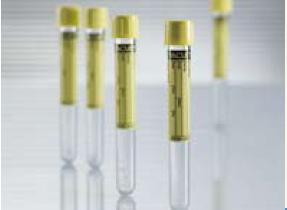 VACUETTE® Urinalysis Tube Plain 6.5 mL Screw Cap Polyethylene Terephthalate (PET) Tube - BeHope