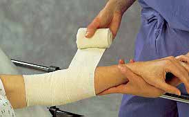 Bias Cut Stockinette Albahealth® Nonsterile Medical Dressing - BeHope
