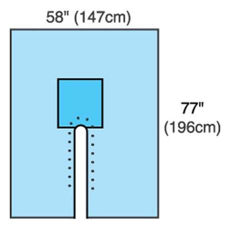 Orthopedic Drape Split Drape 77 W X 120 L Inch Sterile - BeHope